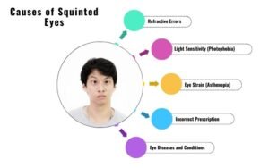 Causes of Squinted Eyes
