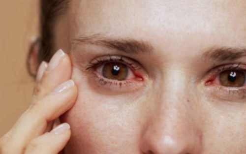 Comprehensive Eye Care Services at a Leading Vision Center in Bangalore Your Guide to Optimal Eye Health (1) Comprehensive Eye Care Services at a Leading Vision Center in Bangalore Your Guide to Optimal Eye Health (1)